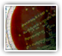 Untreatable: Today's Drug-Resistant Health Threats
