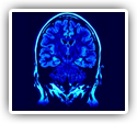 Complications Following Brain Surgery Improved With Chiropractic Care: A Case Study