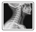 Chiropractic Care Linked to Increased Disc Height in the Neck