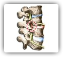 Image for Vertebral Subluxation Highly Prevalent in Patients Seeking Chiropractic Care